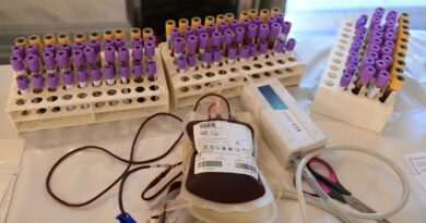 Ερώτηση Βουλευτών του ΣΥΡΙΖΑ–ΠΣ για τις επικίνδυνες ελλείψεις αίματος – Σε κίνδυνο χιλιάδες ασθενείς